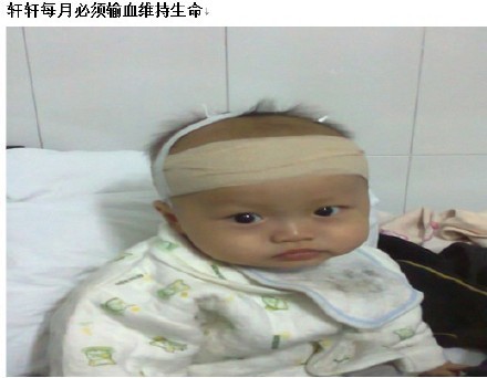 善心莲心 <wbr>助医β-重型地中海贫血患儿林承轩