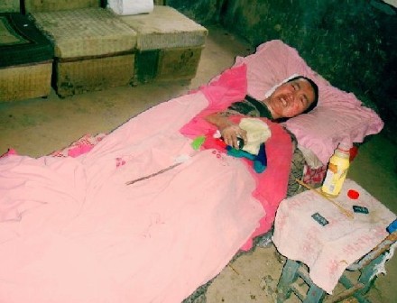 善心莲心 <wbr>捐助强直性脊柱炎重症患者刘发飞