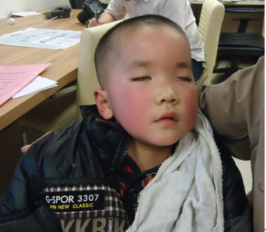 善心莲心 <wbr>捐助脑肿瘤患儿成朋医疗费