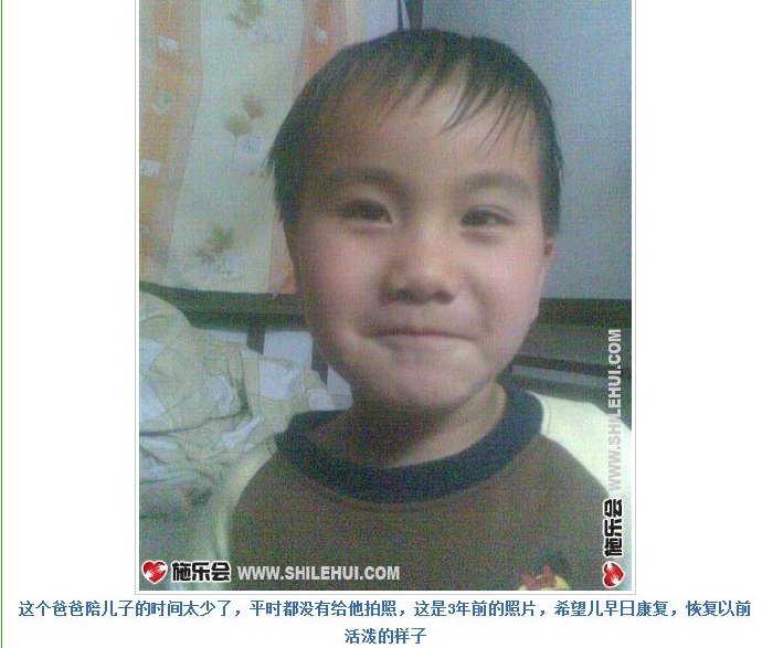 善心莲心&nbsp;<wbr>助医陈东升颅骨修复手术费用