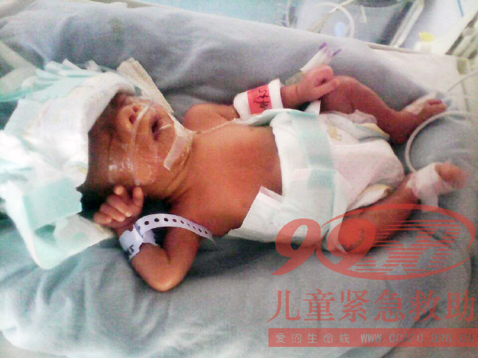 善心莲心&nbsp;<wbr>助医肺部感染患儿孙宇杰