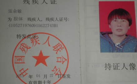 善心莲心&nbsp;<wbr>助医脊柱侧弯患者张会敏