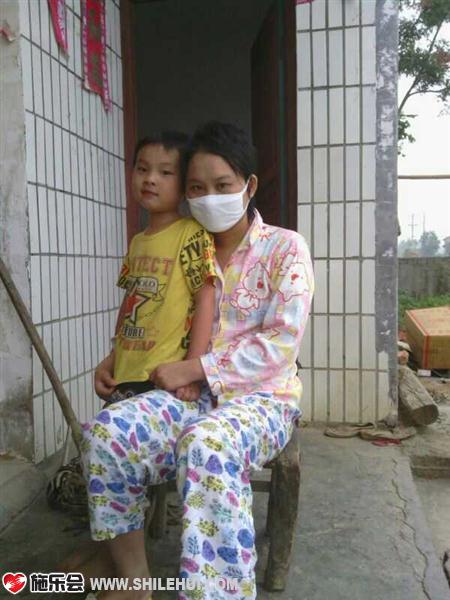 善心莲心&nbsp;<wbr>助医曾丽丽骨髓移植康复治疗费