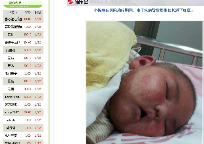 善心莲心&nbsp;<wbr>助医代谢病患儿唐婉瑜