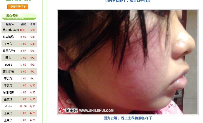 善心莲心&nbsp;<wbr>助医白血病患者徐义娟医疗费