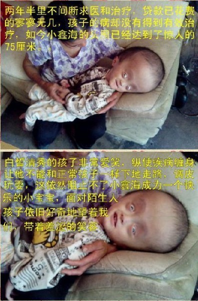 善心莲心&nbsp;<wbr>捐助脑积水患儿姜鑫海医疗费