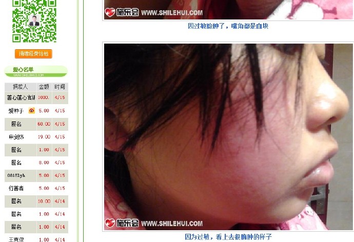 善心莲心&nbsp;<wbr>助医白血病患者徐义娟医疗费