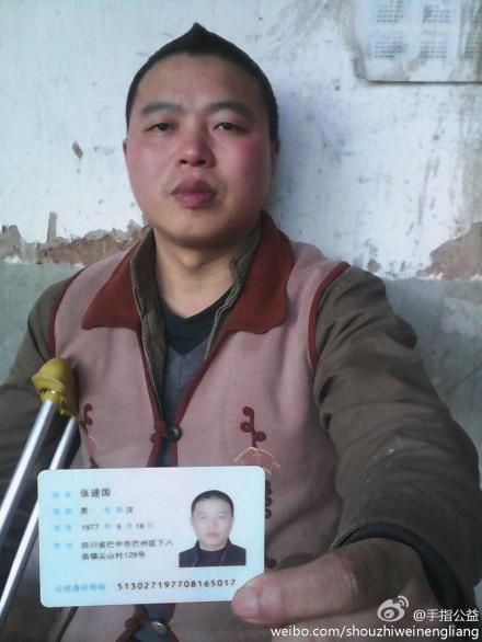 善心莲心&nbsp;<wbr>助医脑梗患者张建国