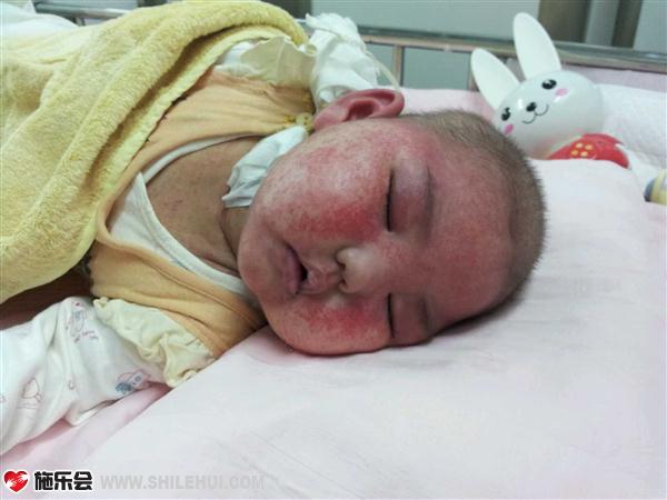 善心莲心&nbsp;<wbr>助医代谢病患儿唐婉瑜