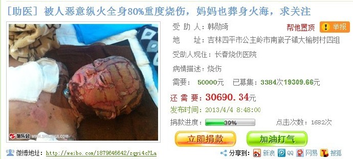 善心莲心&nbsp;<wbr>捐助烧伤患儿韩勋琦